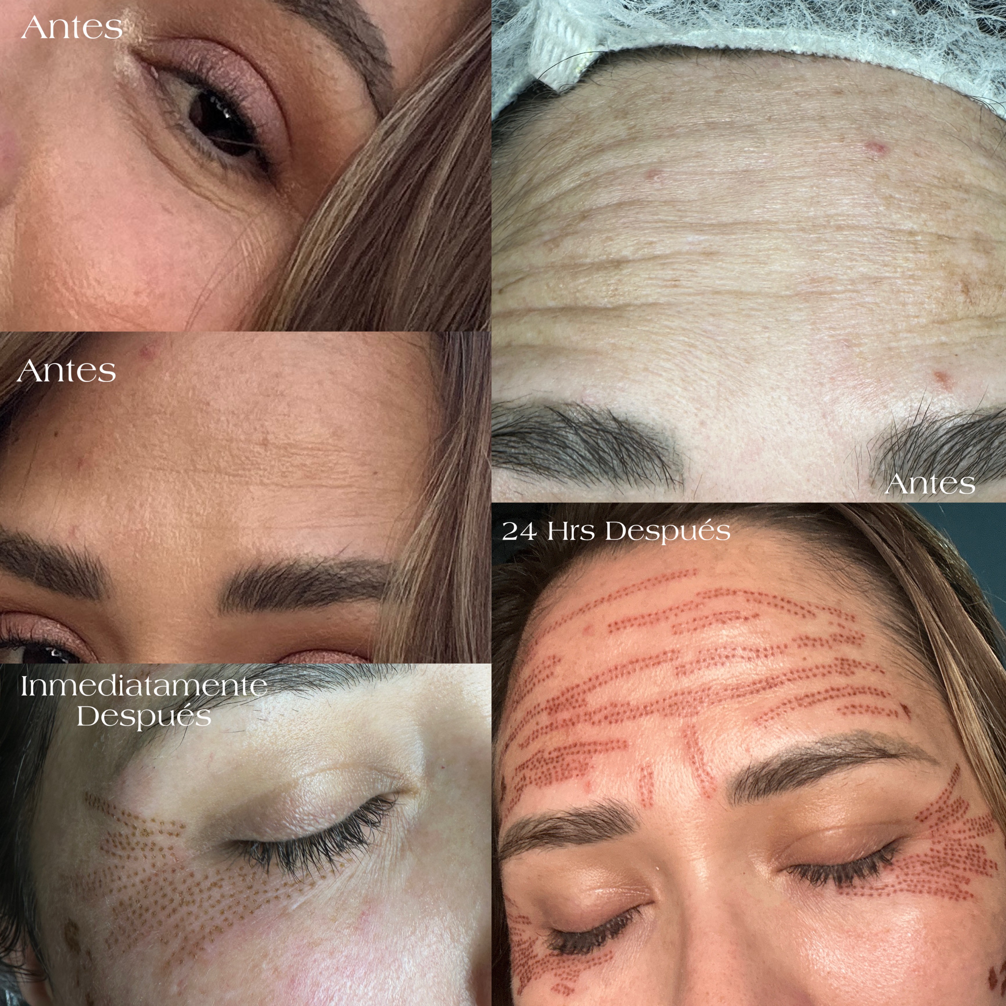 Limpieza Facial Básica