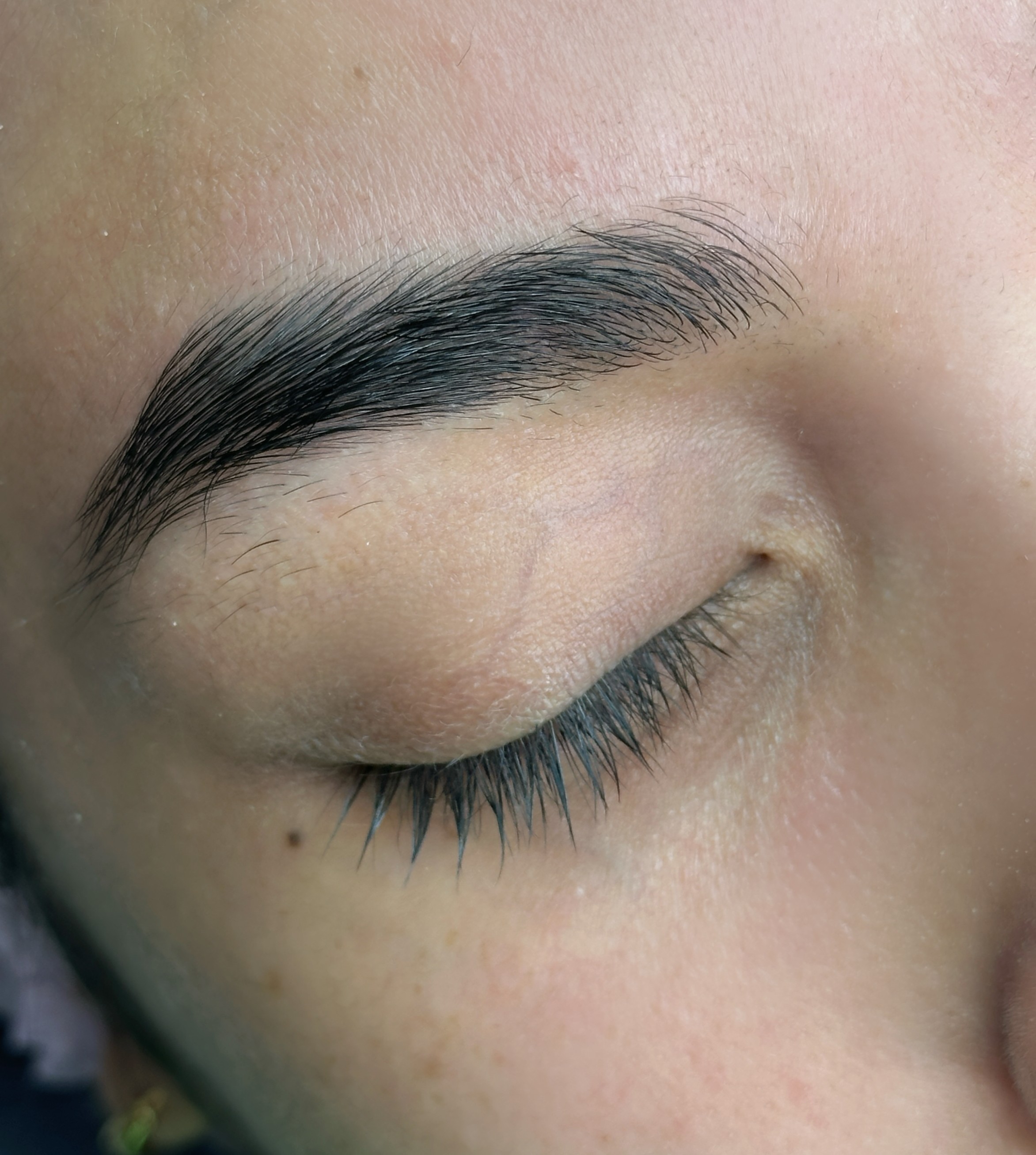 Limpieza Facial Profunda
